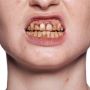 Kryolan Tooth Enamal Red