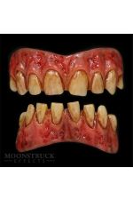 Moonstruck Urit Stained Teeth