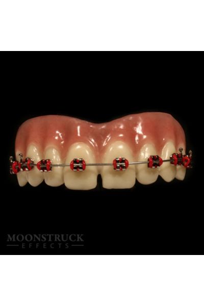 Moonstruck Lemmy Teeth