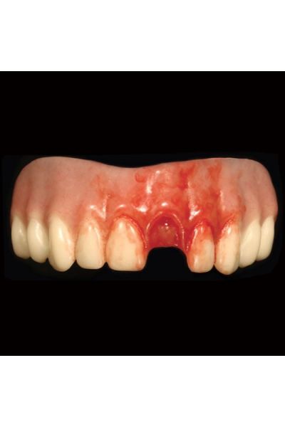 Moonstruck Mordred Stained Teeth (23500)