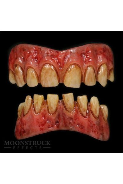 Moonstruck Urit Stained Teeth