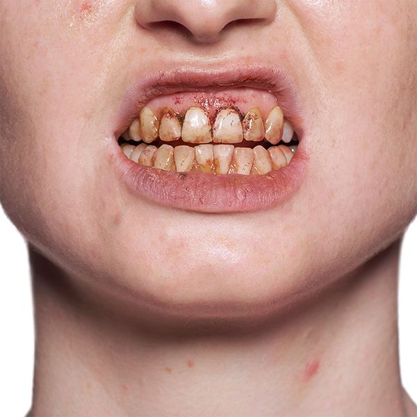 Kryolan Tooth Enamal Red