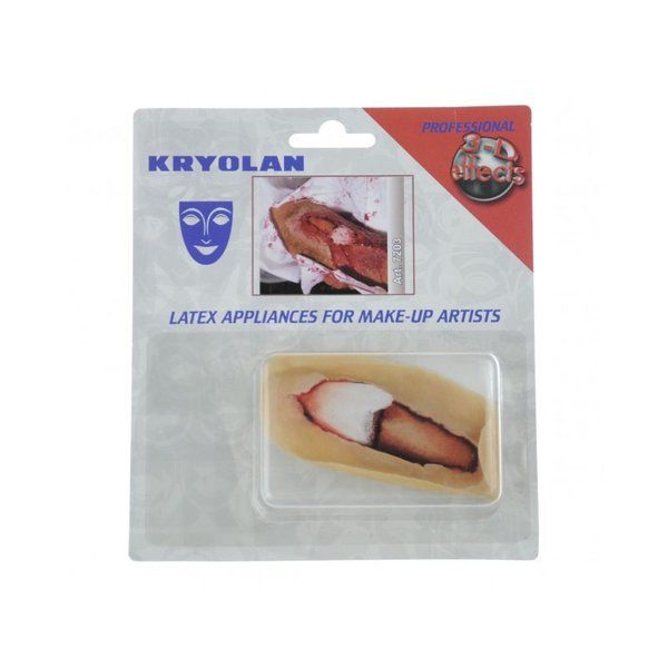 Kryolan open botbreuk